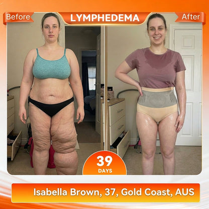 👩‍⚕️🎁𝐎𝐟𝐟𝐢𝐜𝐢𝐚𝐥 𝐁𝐫𝐚𝐧𝐝 𝐒𝐭𝐨𝐫𝐞 |✅𝐊𝐊𝐈𝐎® 𝟐𝟎𝟐𝟔 𝐌𝐨𝐫𝐢𝐧𝐠𝐚 & 𝐁𝐞𝐫𝐛𝐞𝐫𝐢𝐧𝐞 𝟒-𝐈𝐧-𝟏 𝐌𝐢𝐜𝐫𝐨-𝐏𝐚𝐫𝐭𝐢𝐜𝐥𝐞 𝐒𝐜𝐮𝐥𝐩𝐭𝐢𝐧𝐠 & 𝐅𝐚𝐭-𝐁𝐮𝐫𝐧 𝐒𝐡𝐨𝐫𝐭𝐬